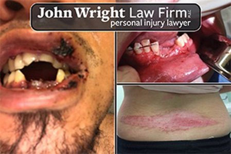 Vaping & E-Cigarette Hazards 